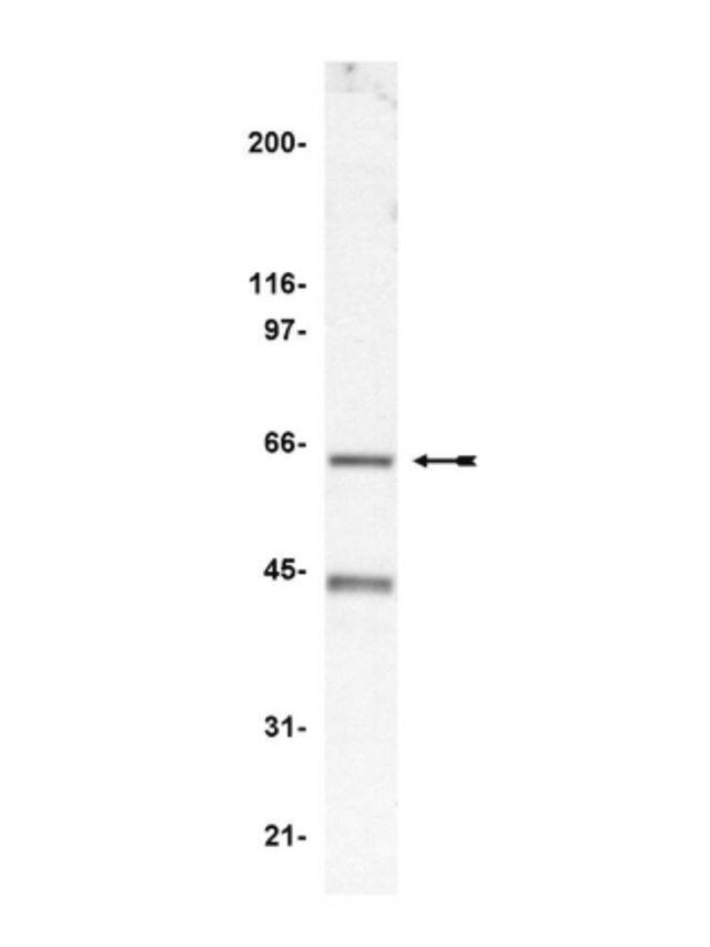 Anti-p67-phox Antibody