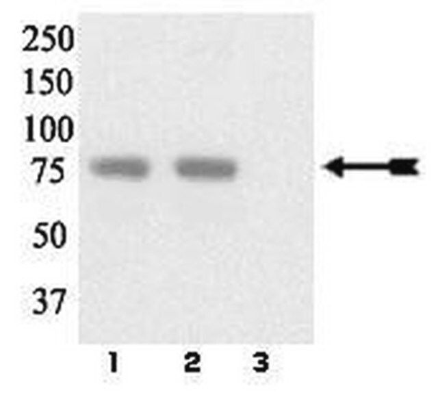 Anti-phospho-LIMK 1/2 (Tyr507/Thr508) Antibody