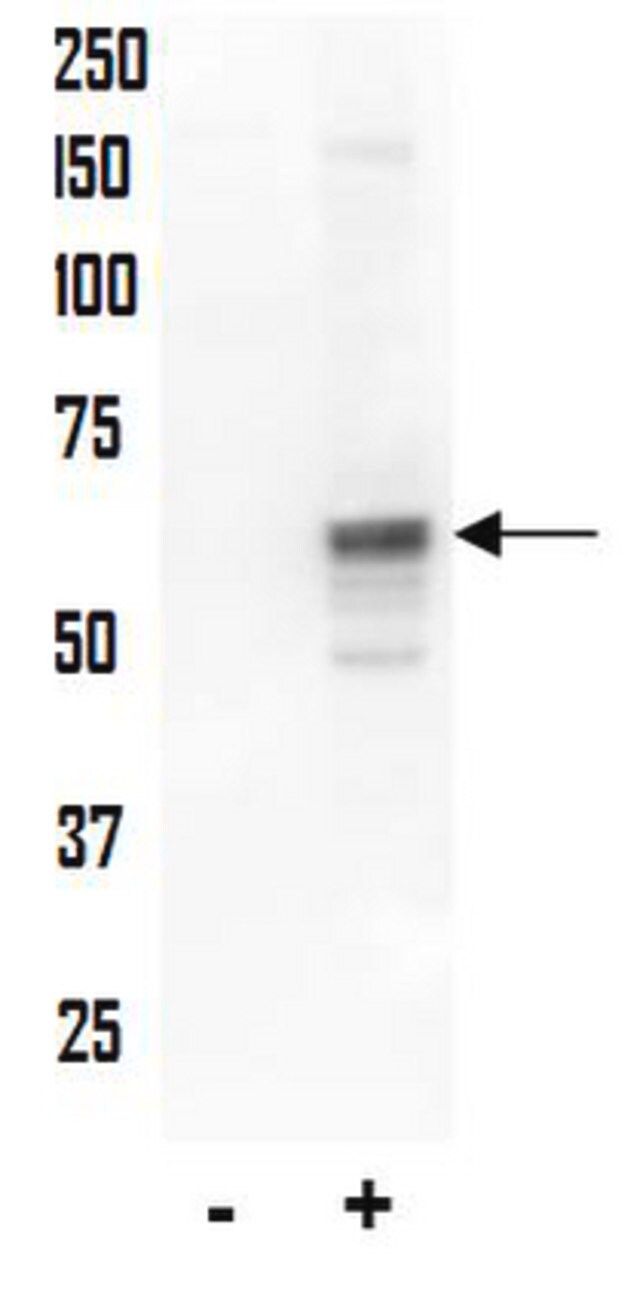 Anti-phospho-AKT (Thr34) Antibody