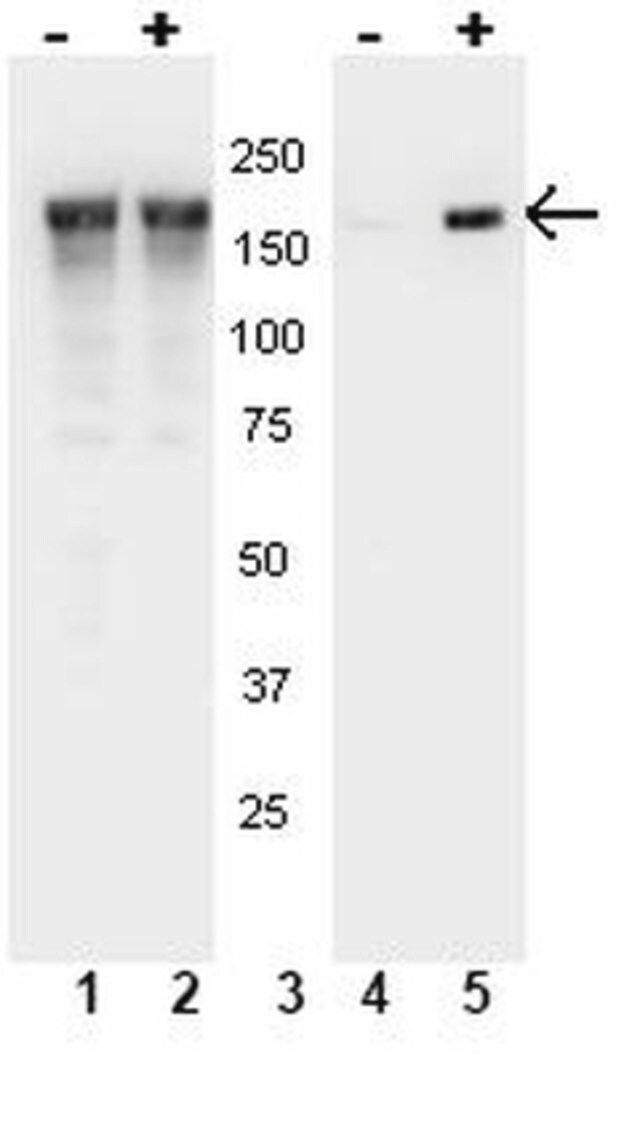 Anti-phospho-EGFR (Tyr1148) Antibody