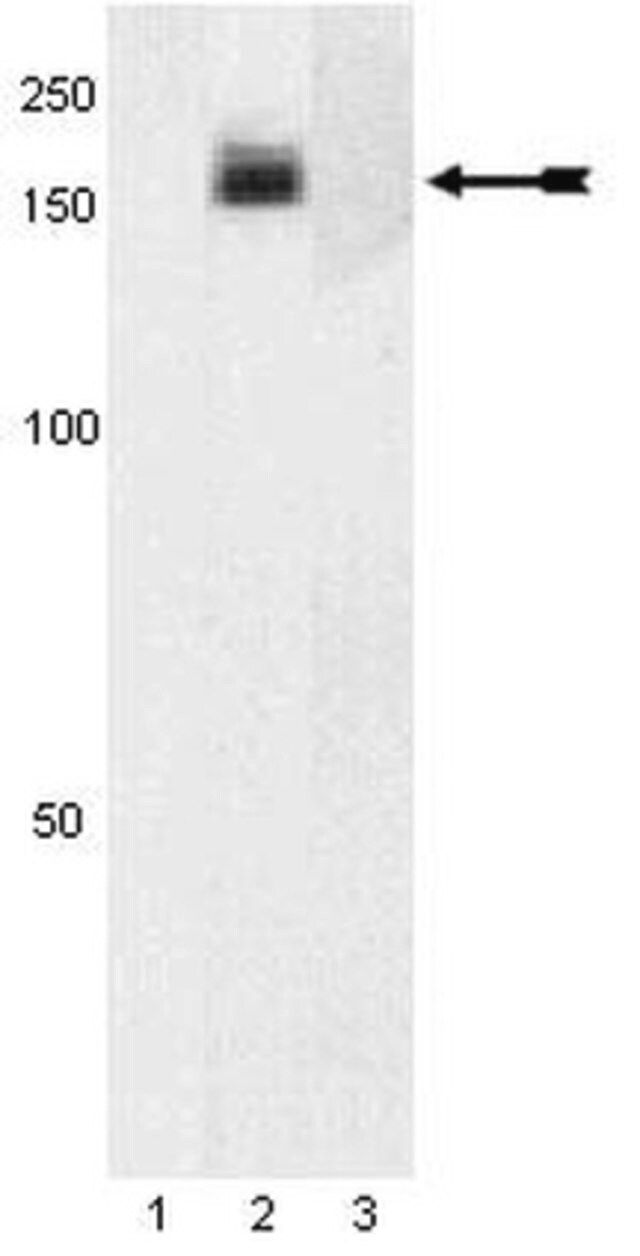 Anti-phospho-PDGFR (Tyr754) Antibody