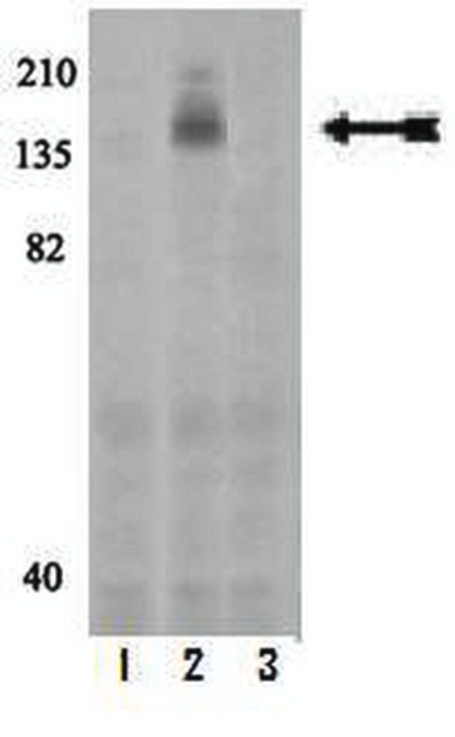 Anti-phospho-c-Kit (Tyr568/Tyr570) Antibody