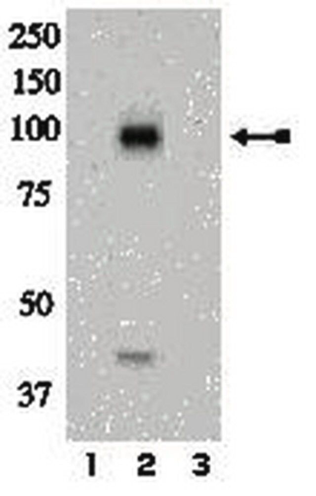 Anti-phospho-IR (Tyr972) Antibody