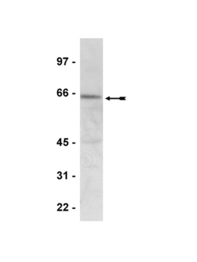 Anti-phospho-AMPK  (Thr172) Antibody