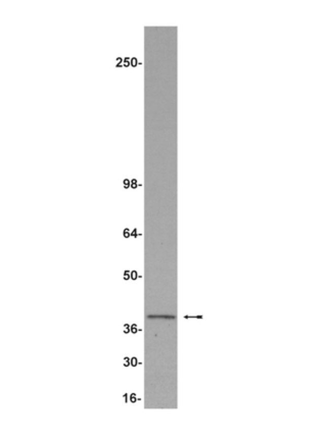 Anti-REA Antibody