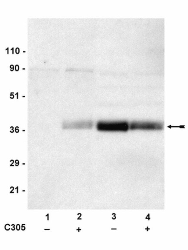 Anti-phospho-LAT (Tyr191) Antibody