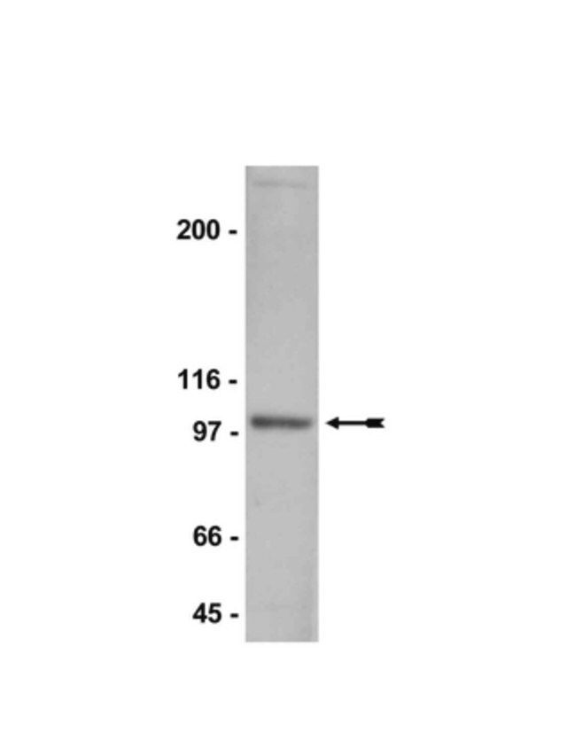 Anti-NR3B Antibody