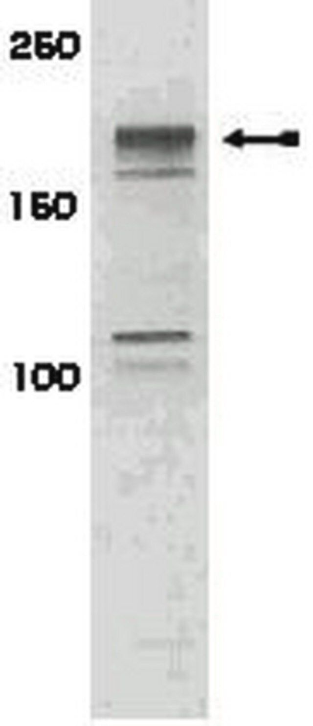 Anti-phospho-IRS1 (Ser616) Antibody