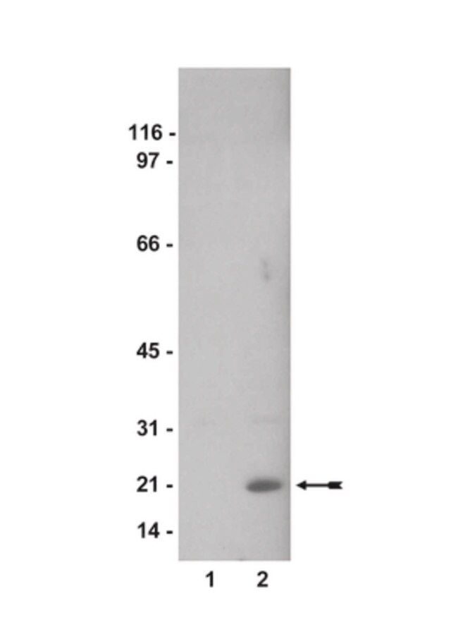 Anti-phospho-Cofilin 2 (Ser3) Antibody