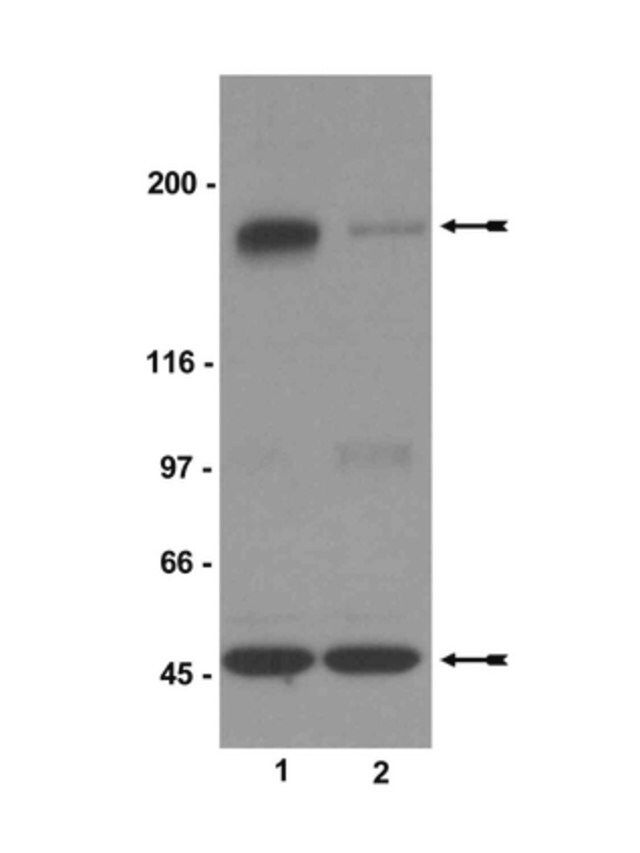 Anti-phospho-NR2B (Ser1303) Antibody