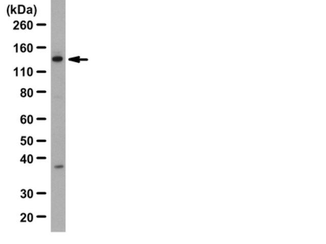 Anti-Upf1 Antibody