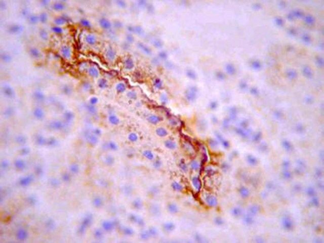 Anti-SGLT-1 (Sodium Glucose Co-transporter-1) Antibody