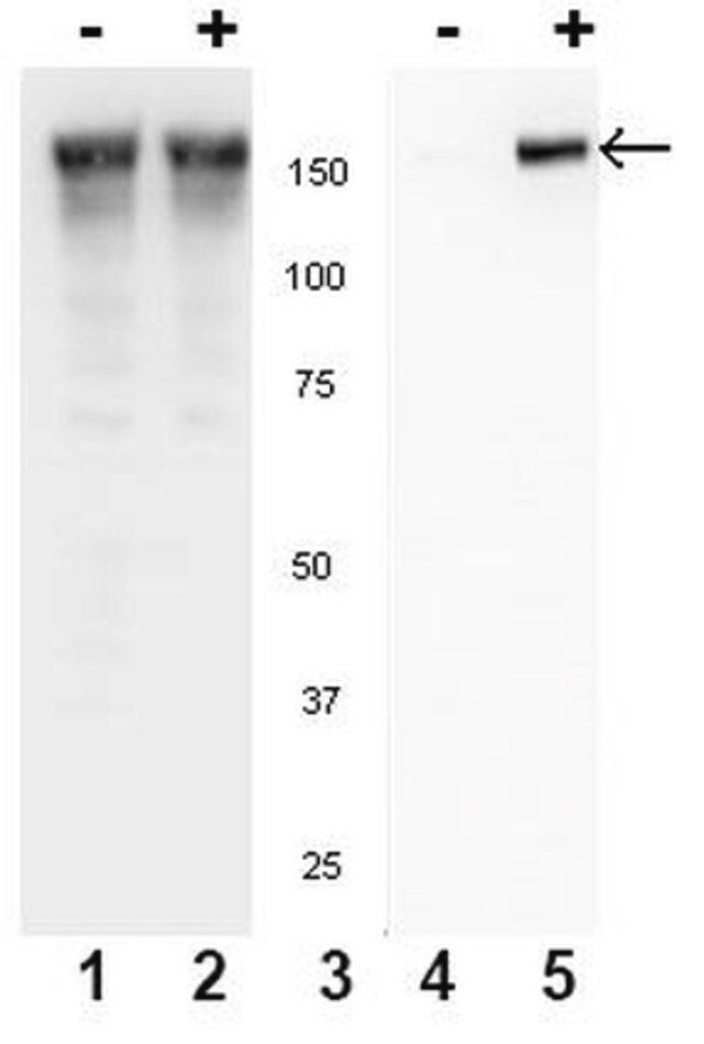 Anti-phospho-EGFR (Tyr845) Antibody