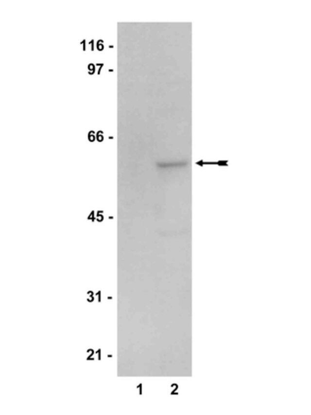 Anti-AMPK 2 Antibody