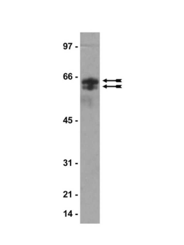 Anti-Citrulline Antibody