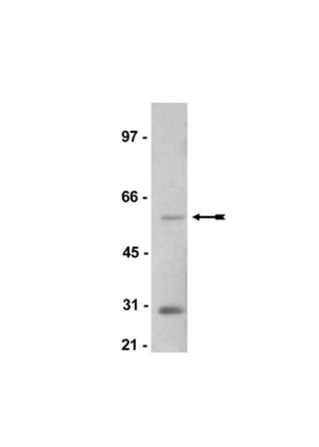 Anti-SGK1 Antibody