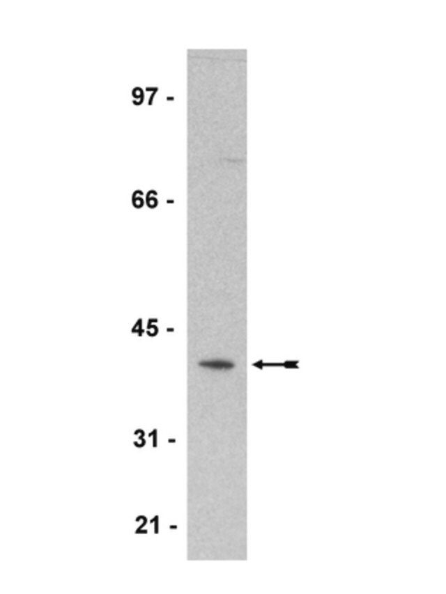 Anti-Spry2 Antibody