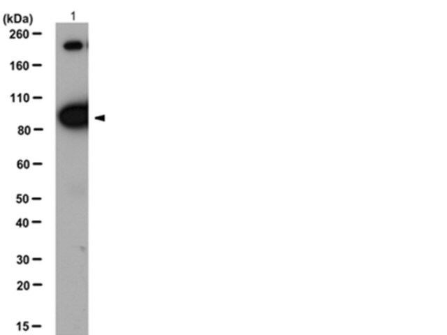 Anti--Insulin Receptor Antibody,  subunit