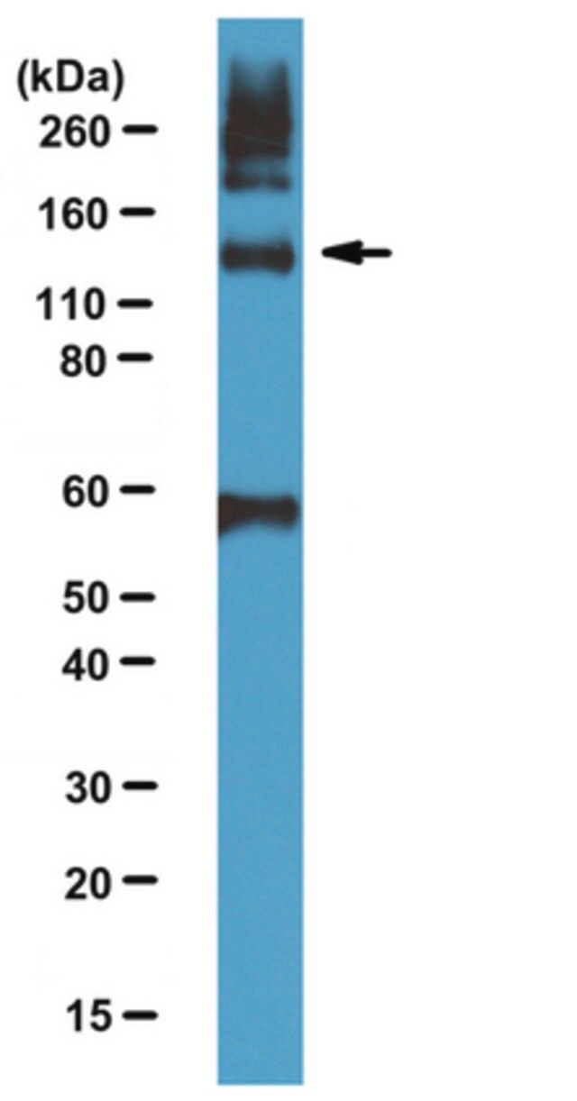 Anti-Tie-2 Antibody, NT