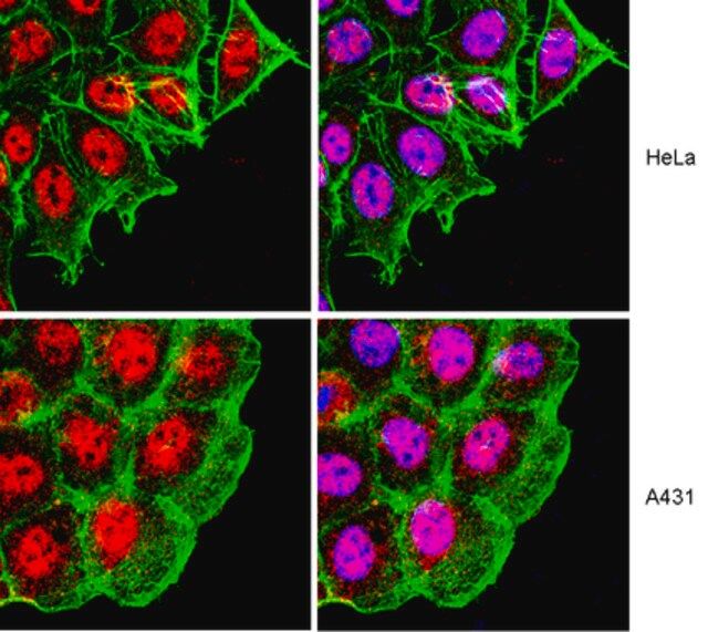 Anti-RAD50 Antibody