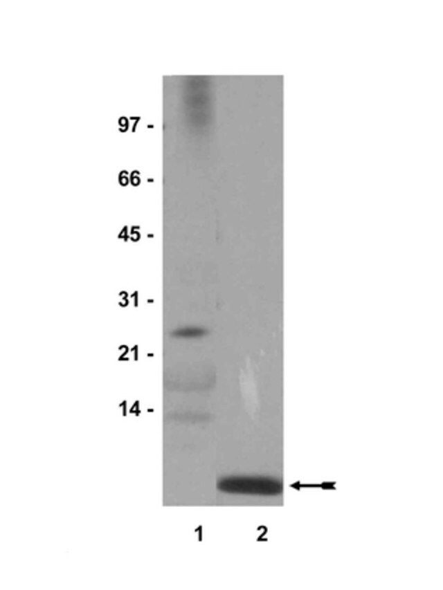 Anti-Ubiquitin Antibody