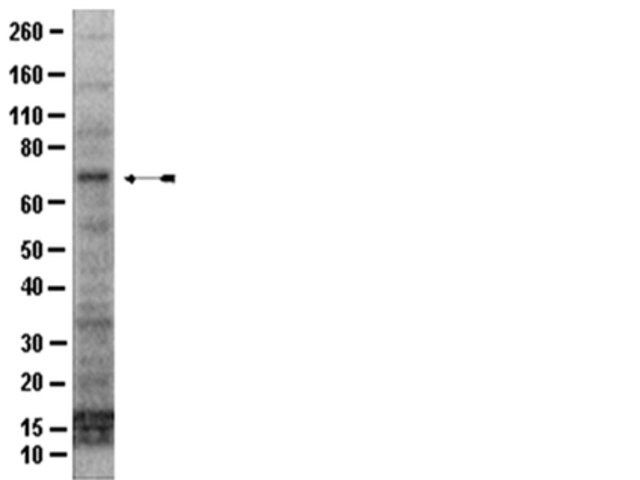 Anti-IRAK1 Antibody, CT