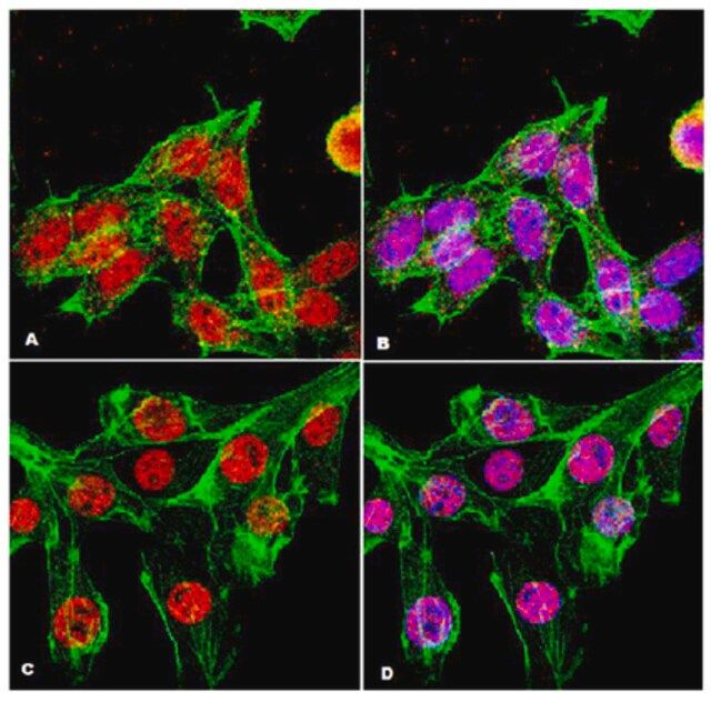 Anti-ATM Antibody