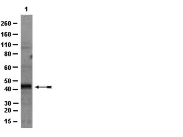 Anti-HDAC11 Antibody