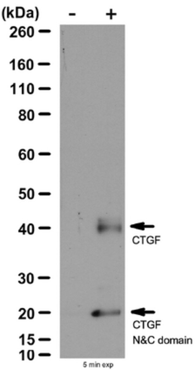 Anti-Connective Tissue Growth Factor Antibody