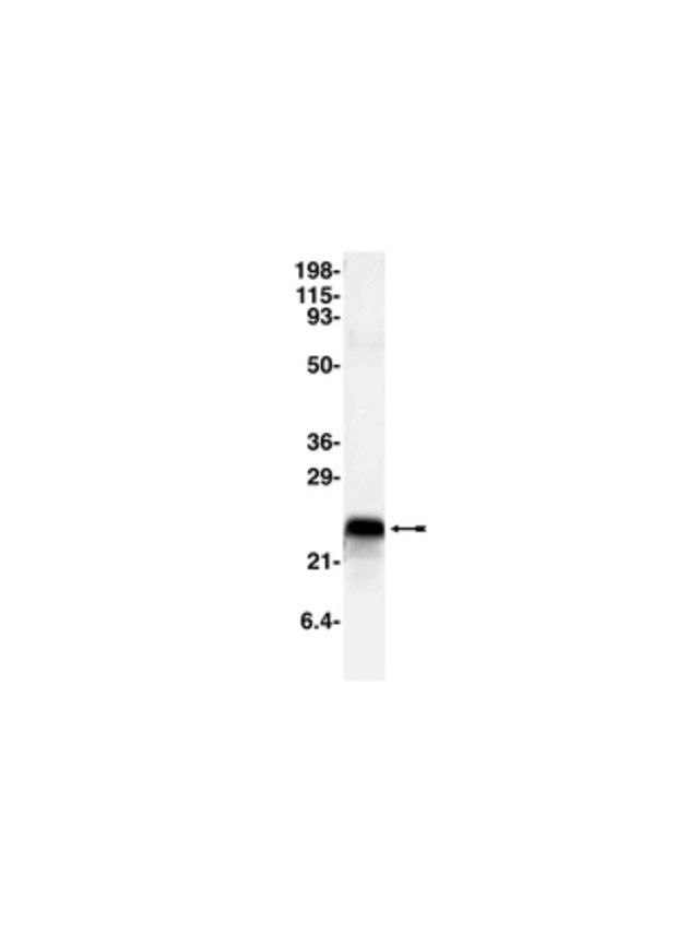 Anti-CPI-17 Antibody