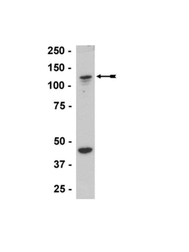 Anti-ADAP/SLAP-130/Fyb Antibody