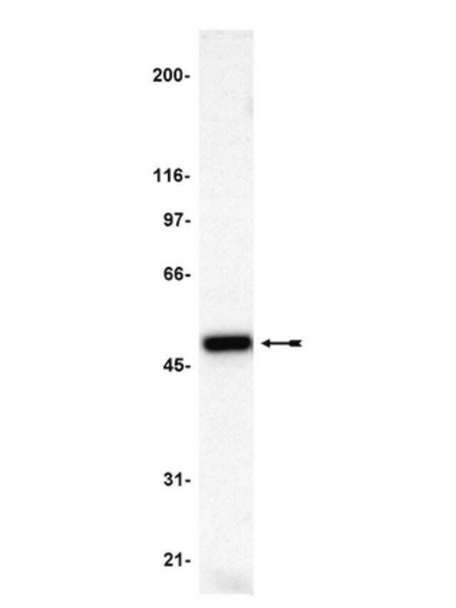 Anti-p47-phox Antibody