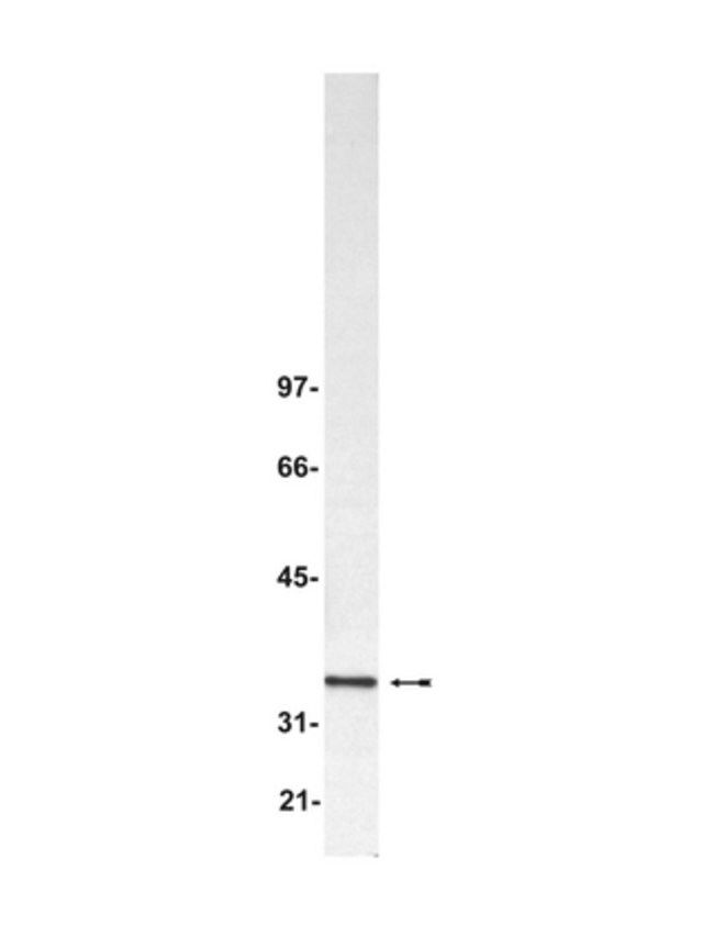 Anti-Blys/TALL-1/BAFF/THANK Antibody