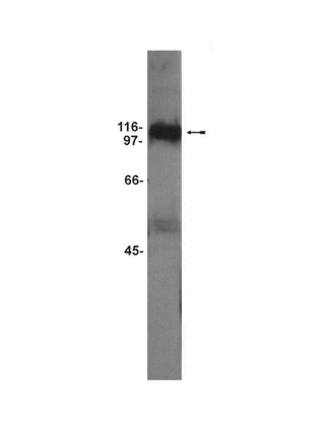 Anti-GluR5 Antibody