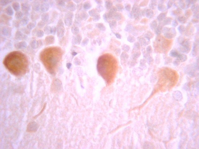 Anti-G Protein Gi 1/2 Antibody