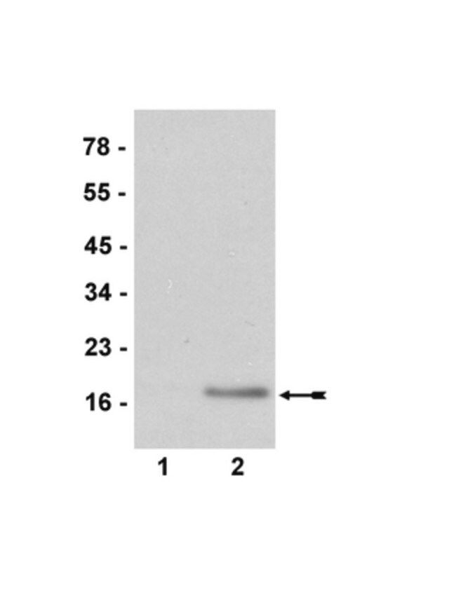 Anti-dimethyl-Histone H3 (Arg2) Antibody