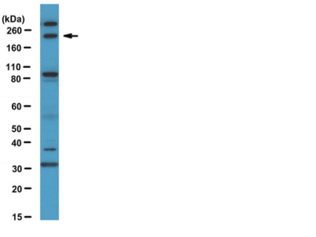 Anti-FIP200 Antibody