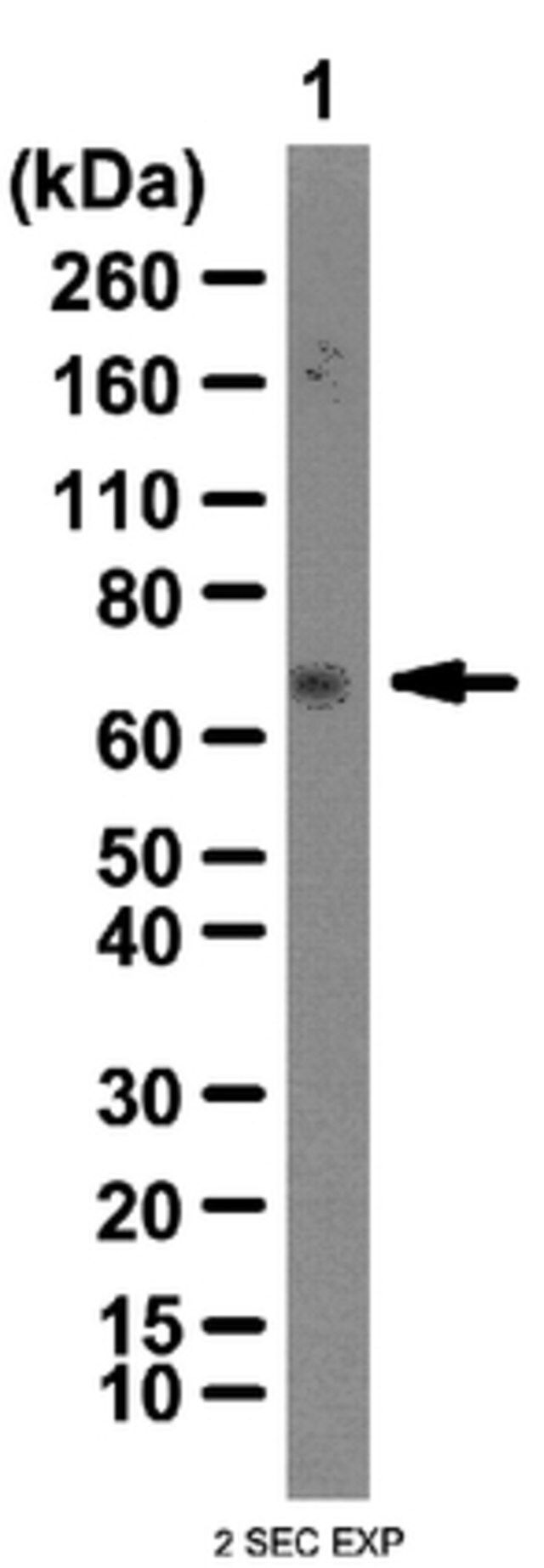 Anti-IGF2 mRNA-binding protein 3 Antibody