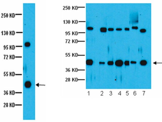 Anti-G5 Antibody