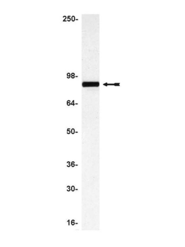 Anti-Ezrin Antibody