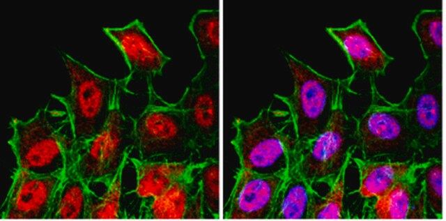 Anti-FOXO3A Antibody