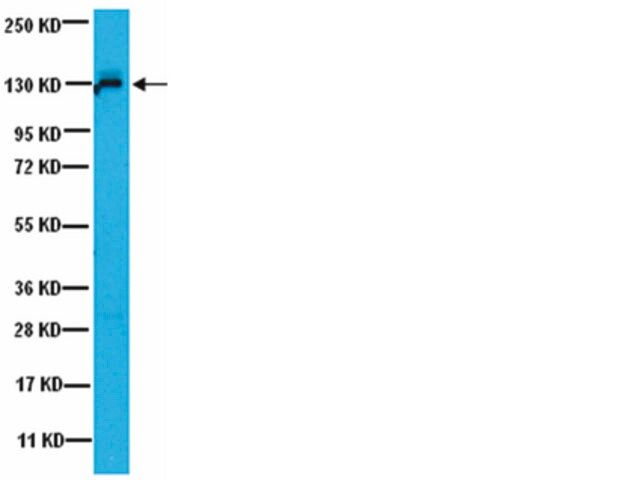 Anti-JAK1 Antibody