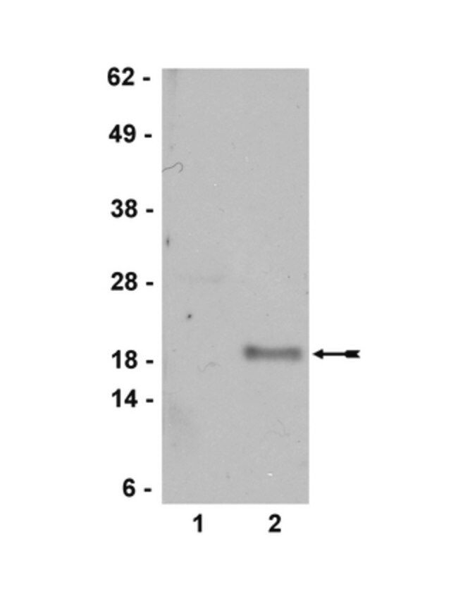 Anti-p19 ARF Antibody