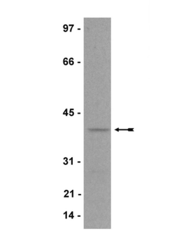 Anti-p40-phox Antibody