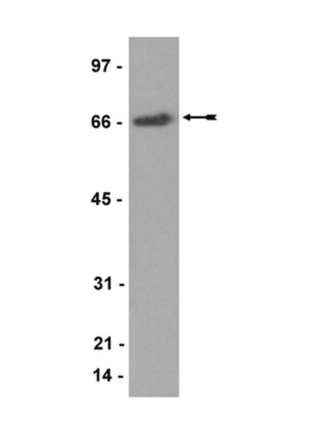 Anti-CoREST Antibody