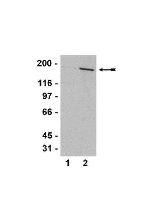 Anti-AS160 (Rab-GAP) Antibody