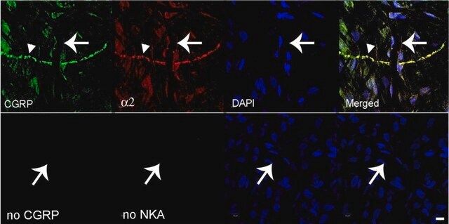 Anti-Na+K+ ATPase -2 Antibody