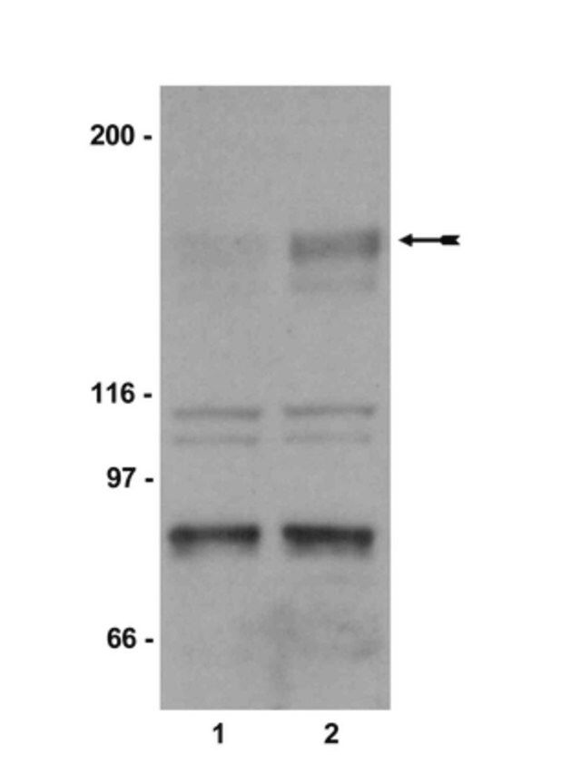 Anti-phospho-KDR/Flk-1/VEGFR2 (Tyr1214) Antibody