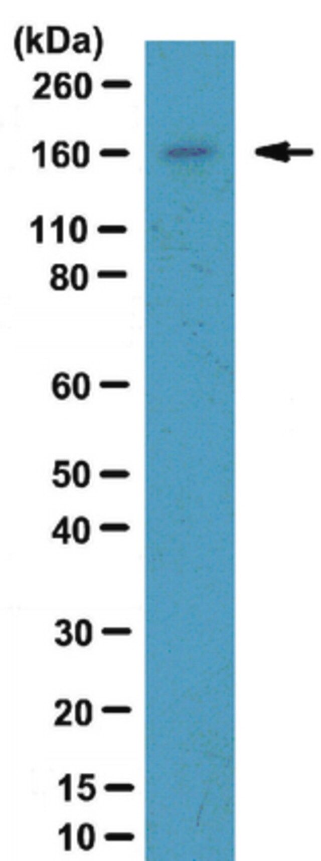 Anti-NCoA-2 Antibody