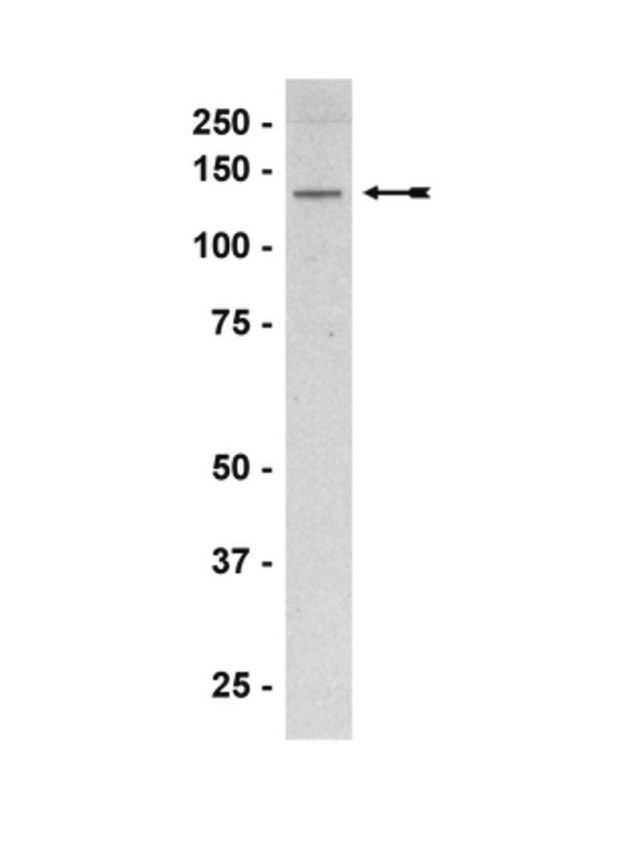 Anti-eNOS/NOS III Antibody, CT